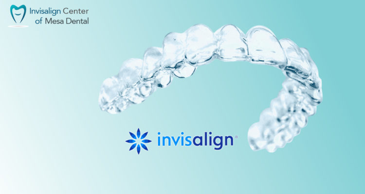 Invisalign Find a Doctor