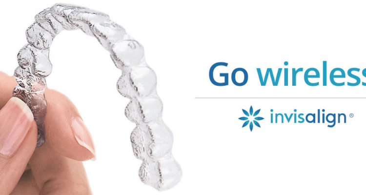 Invisalign Braces Cost