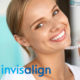 Invisalign dentist in San Diego