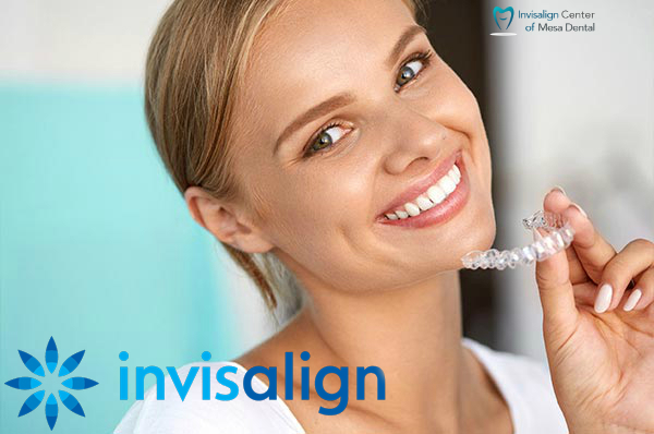 Invisalign dentist in San Diego